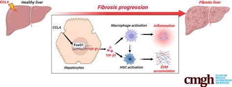 Hepatocyte Foxo Deficiency Protects From Liver Fibrosis Via Reducing