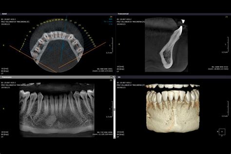 Tomografía Computarizada Cone Beam 3D INARAD