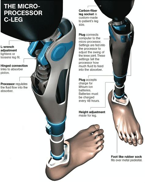 C Leg By Otto Bock It Uses Microprocessor Controlled Hydraulics Which