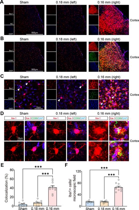 Activated Microglia Examined By Cd68iba 1 Double Staining After Bcas