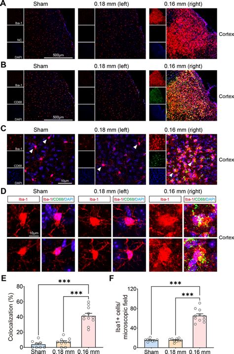 Activated Microglia Examined By CD68 Iba 1 Double Staining After BCAS