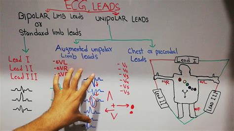 Which Ecg Leads Are Bipolar Top Best Answers Ecurrencythailand