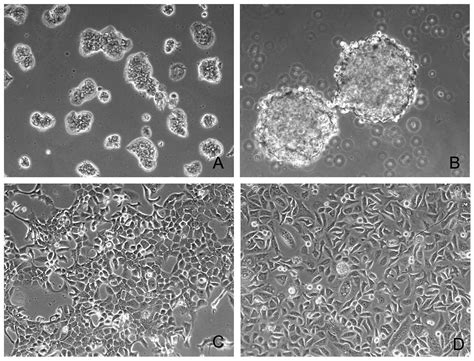 Establishment And Characterization Of Seven Human Breast Cancer Cell