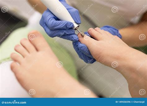 Patient On Medical Pedicure Procedure Stock Photo Image Of Fingernail