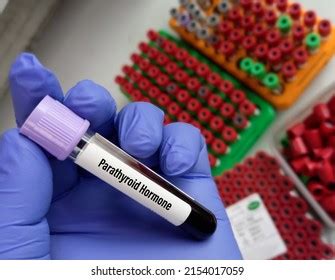 Blood Test Sample Parathyroid Hormonepth Test Stock Photo