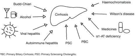 Liver Cirrhosis Hepa Merz Professional Website