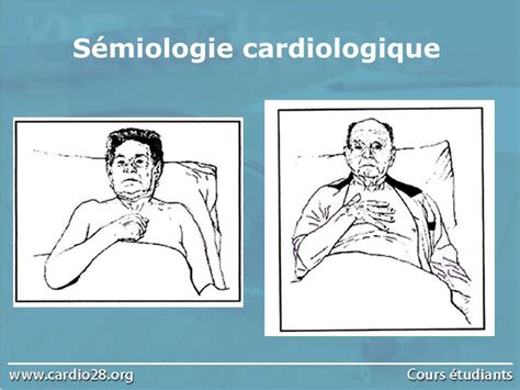 PPT Sémiologie cardiologique PowerPoint Presentation free download