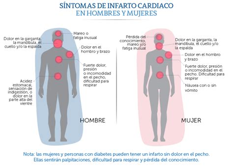 Médica Sur ¿me Está Dando Un Infarto Cardiaco