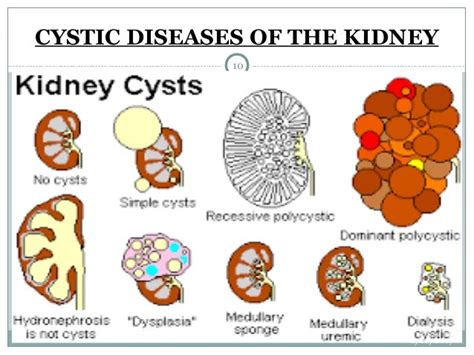 Diseases Of Excretory System