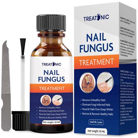 Nail Fungal Treatment for toenail-Fungal Nail Treatment-Toenail Fungal ...