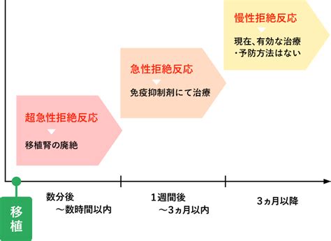 腎移植後の免疫抑制療法：レシピエント（腎臓の提供を受ける方）の腎移植の流れ：腎移植 大阪大学大学院医学系研究科泌尿器科