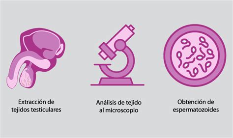 Biopsia Testicular Cl Nica Ginecol Gica Elcano