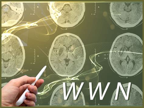 Warsztaty Z Neuroradiologii G Owa Premium Clinic Wroc Aw