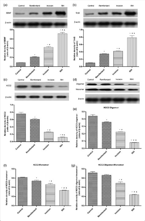 The Expression Of BDNF TrkB Total KCC2 KCC2 Oligomer Monomer And