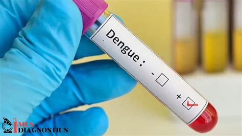 Dengue fever ! All you need to Know about the Disease