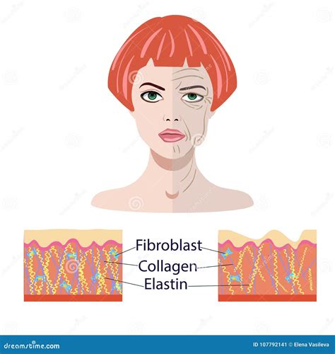 Vector Face And Two Types Of Skin Aged And Young For Medical And