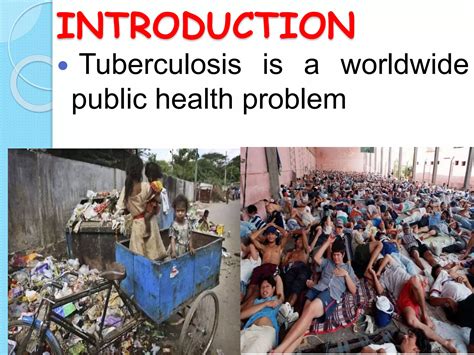 Tuberculosis Ppt Ppt