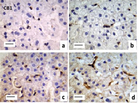 Representative Photomicrographs Of Immunohistochemical Finding For Cb1 Download Scientific