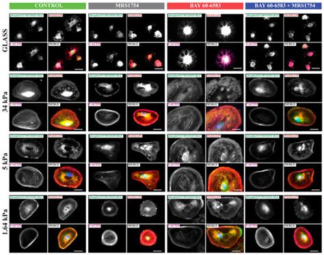 Cells Free Full Text Pharmacological Blockade Of The Adenosine A2b