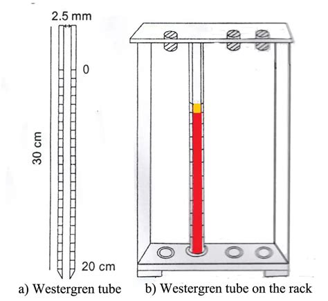 Erythrocyte Sedimentation Rate (ESR) : Principle, Methods of Determination and Clinical ...