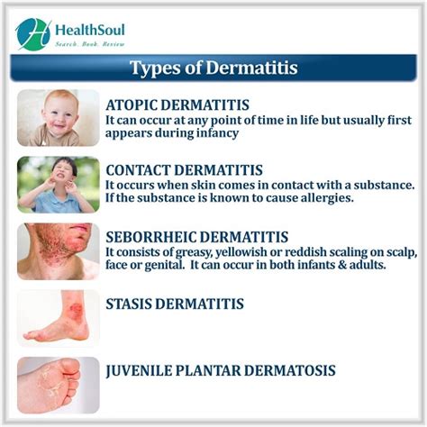 Dermatitis Definition Types Causes Symptoms And Treatment Images And Photos Finder