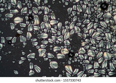 Potato Starch Grains Under Microscope 200x Stock Photo 1557330743 ...