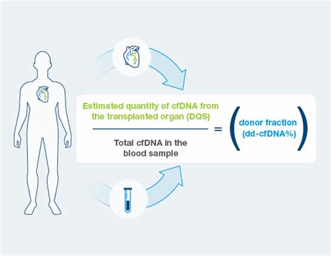 Prospera Heart Overview Cell Free Dna Testing Natera