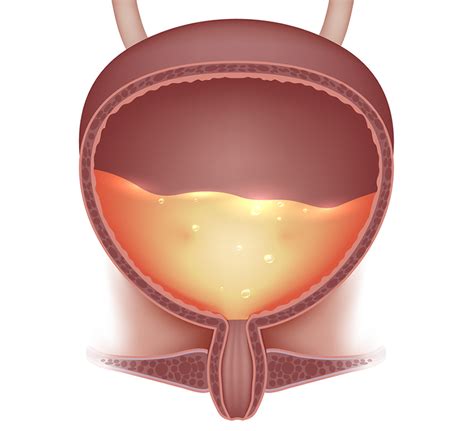 Neurogenic Bladder | Star Clinic