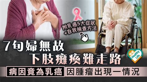 乳癌警號︳7旬婦無故下肢癱瘓難走路 病因竟為乳癌 因腫瘤出現一情況︳附乳癌5大症狀自我檢查方法 晴報 健康 腫瘤及癌症 D230222