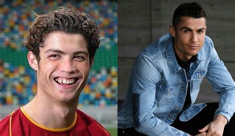 O Antes E Depois De Jogadores Que Mudaram Bastante De Visual Moda