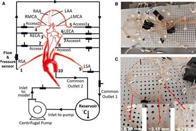 Frontiers Modeling Flow In An In Vitro Anatomical Cerebrovascular