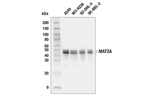 MAT2A E5I7C Rabbit MAb Cell Signaling Technology