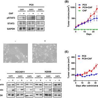 Effect Of Tranilast On Cancerassociated Fibroblast Caf Induced Drug