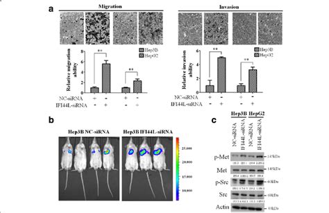 Ifi L Functions As A Tumor Suppressor Affecting Metastasis Implicates