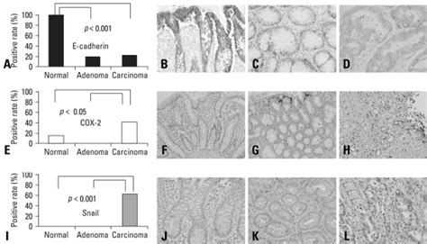 Immunohistochemical Staining For E Cadherin B C D Cox F G H