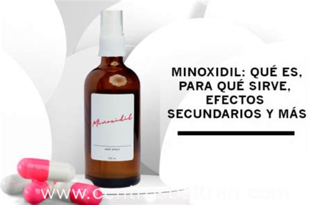 Minoxidil Qu Es Efectos Secundarios Es Efectivo Centros Beltr N