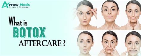 Botox Aftercare For Batter Result Follow Tips Arrowmeds