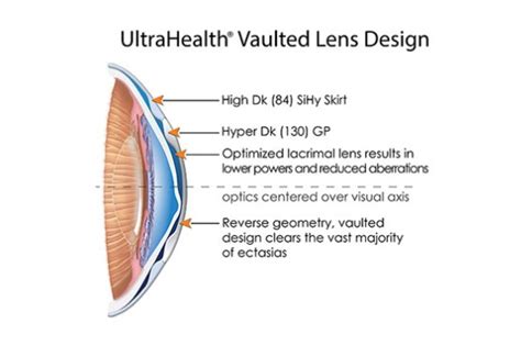 Hybrid Lenses | New Braunfels Vision Center