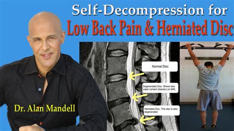 Self Decompression For Lower Back Pain Herniated Disc Pinched Nerve