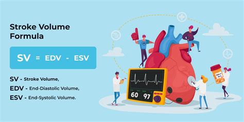 Stroke Volume Calculation Lone Star Neurology