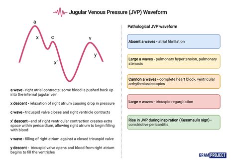 JVP Waveform - Gram Project