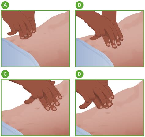 Tecnicas Para El Examen Fisico Del Abdomen Hot Sale Mediawok