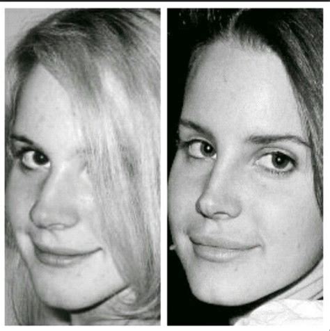 Lana Del Rey Face Plastic Surgery Plastic Surgery Nose Job