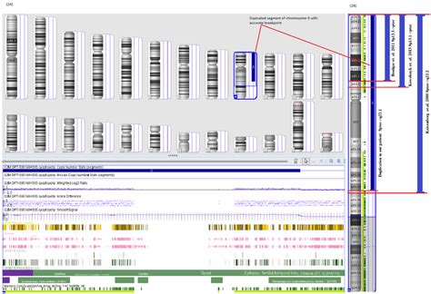 Array-CGH findings. (A), Array-CGH image showing duplication of... | Download Scientific Diagram