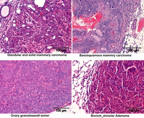 Histopathology Of Tumors From Dmba Treated Mice Depicting Some