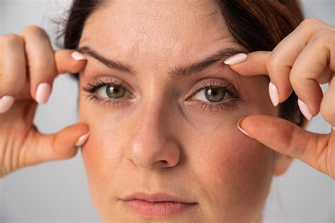 How Much Does Upper Eyelid Surgery Cost In Annandale Va Jae Kim Md