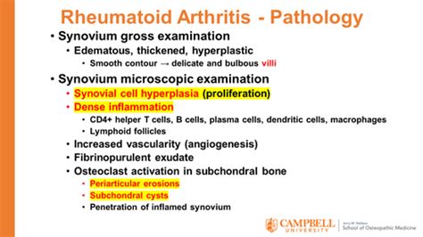 Msk Joint Pathology Flashcards Quizlet