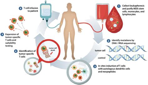 Adoptive Transfer Of Neoantigen Specific T Cell Therapy Is Feasible In