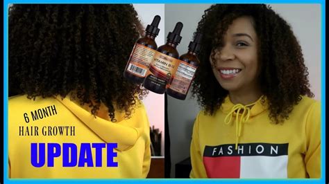 Liquid Biotin Update Hair Growth Months Later Youtube