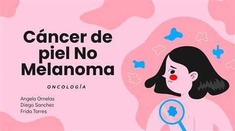 Cancer De Piel No Melanoma Frida Torres Casta Eda Udocz